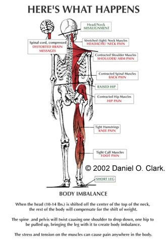 Chiropractic Sebastopol CA Skeleton Diagram